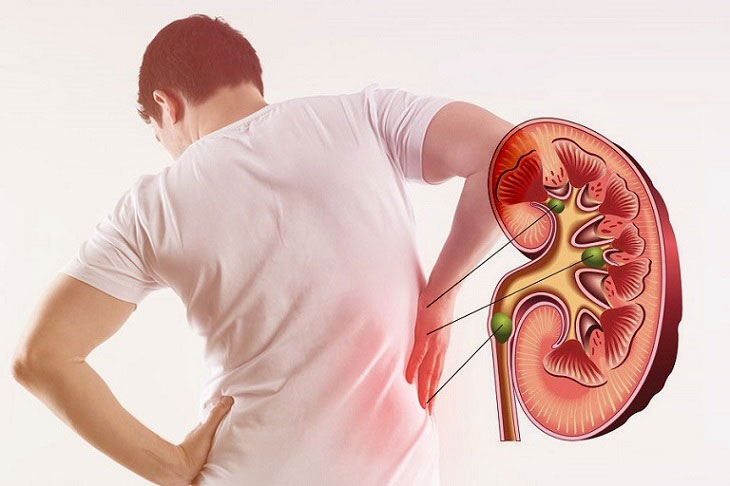 Người mắc bệnh thận yếu