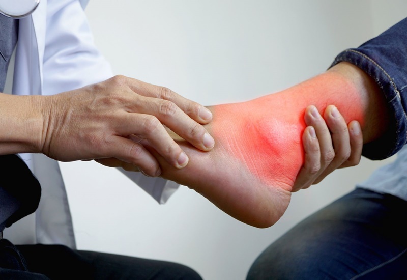 [Mách Bạn] Chữa Bệnh Gout Bằng Lá Cây Quen Thuộc Trong Vườn
